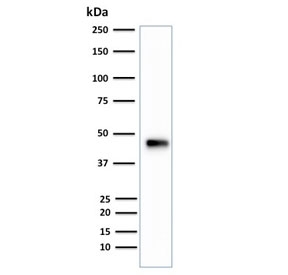 Western blot testing of human HCT-116 cell lysate with CK18 antibody (clone B23.1). Expected molecular weight: 46-50 kD