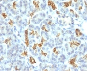 IHC: Formalin-fixed, paraffin-embedded human pancreas stained with Cytokeratin 19 antibody (KRT19/799).