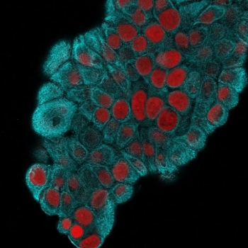 Immunofluorescent staining of MeOH fixed human MCF7 cells with Cytokeratin 19 antibody (clone KRT19/800, blue) and Reddot nuclear stain (red).