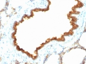 IHC: Formalin-fixed, paraffin-embedded rat lung stained with CK19 antibody