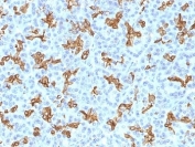 IHC: Formalin-fixed, paraffin-embedded human pancreas stained with CK19 antibody