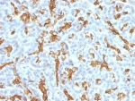IHC: Formalin-fixed, paraffin-embedded human pancreas stained with Cytokeratin 19 antibody (KRT19/799 + KRT19/800).