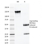 SDS-PAGE Analysis of Purified, BSA-Free Luteinizing Hormone beta Antibody (clone LHb/1214). Confirmation of Integrity and Purity of the Antibody.