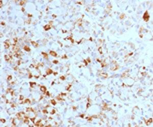 IHC testing of formalin-fixed, paraffin-embedded human pituitary stained with Luteinizing Hormone beta antibody (clone LHb/1214).~