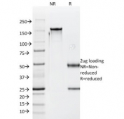 SDS-PAGE analysis of purified, BSA-free Luteinizing Hormone beta antibody (clone SPM103) as confirmation of integrity and purity.