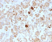 IHC testing of formalin-fixed, paraffin-embedded human pituitary stained with Luteinizing Hormone beta antibody (clone SPM103).