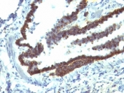 IHC: Formalin-fixed, paraffin-embedded rat lung stained with EpCAM antibody (clone EGP40/1110).