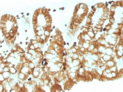 IHC testing of FFPE mouse colon tissue with EpCAM antibody (clone EGP40/1110). Required HIER: boil tissue sections in 10mM Citrate buffer, pH 6.0, for 10-20 min followed by cooling at RT for 20 min.