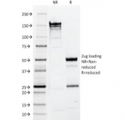 SDS-PAGE analysis of purified, BSA-free EpCAM antibody (clone EGP40/1110) as confirmation of integrity and purity.