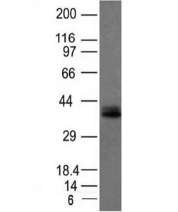 Western blot analysis of HCT116 cell lysate using EpCAM antibody (EGP40/1120). Expected molecular weight: ~35 kDa (unmodified), 40-43 kDa (glycosylated).~