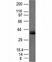 Western blot analysis of HCT116 cell lysate using EpCAM antibody (EGP40/1120). Expected molecular weight: ~35 kDa (unmodified), 40-43 kDa (glycosylated).