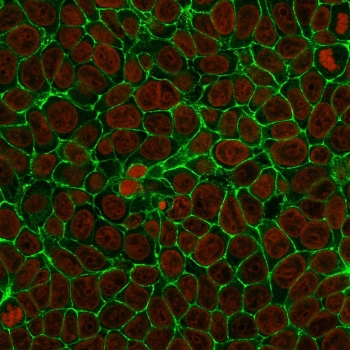 Immunofluorescent staining of human MCF7 cells with anti-EpCAM antibody (clone SPM134, green) and Reddot nuclear stain (red).~
