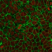 Immunofluorescent staining of human MCF7 cells with unlabeled anti-EpCAM antibody (clone SPM134, green) + CF488-labeled secondary and Reddot nuclear stain (red).