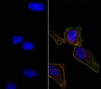 Right: Confocal Immunofluorescent analysis of SK-OV-3 cells using AF488-labeled EpCAM antibody (EGP40/826) (Green). F-actin filaments were labeled with DyLight 554 Phalloidin (red). Left: Negative control. DAPI was used to stain the cell nuclei (blue).~