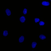 Immunofluorescent staining of human SK-OV-3 cells with isotype control antibody (green) and DAPI nuclear stain (blue).