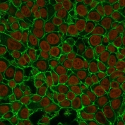 Immunofluorescent staining of human MCF7 cells with EpCAM antibody (clone EGP40/837, green) and Reddot nuclear stain (red).