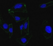 Confocal Immunofluorescent analysis of SK-OV-3 cells using AF488-labeled EpCAM antibody (green). DAPI was used to stain the cell nuclei (blue).