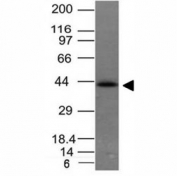 Western blot of HCT116 cell lysate using EpCAM antibody (EGP40/837). Expected molecular weight: ~35 kDa (unmodified), 40-43 kDa (glycosylated).