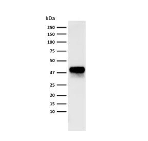 Western blot testing of human lung lysate with EpCAM antibody cocktail (clone PAN-EpCAM).~