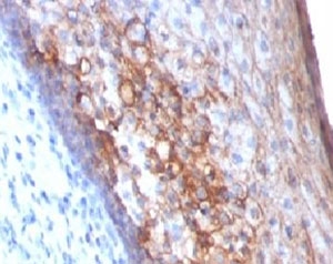 IHC: Formalin-fixed, paraffin-embedded human tonsil stained with MCAM antibody (MCAM/1101)~