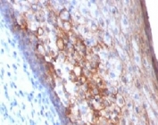 IHC: Formalin-fixed, paraffin-embedded human tonsil stained with MCAM antibody (MCAM/1101)