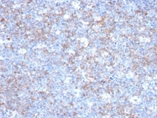 IHC: Formalin-fixed, paraffin-embedded human tonsil stained with CD146 antibody (clone C146/634).