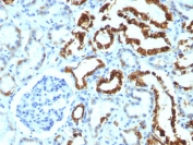 IHC analysis of FFPE human renal cell carcinoma tested with MFGE8 antibody (MFG-06)