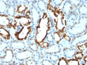 IHC: FFPE human renal cell carcinoma tested with MFG-E8 antibody (SPM291)