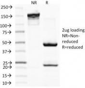 SDS-PAGE Analysis of Purified, BSA-Free MITF Antibody (clone C5/D5). Confirmation of Integrity and Purity of the Antibody.