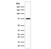 Western blot testing of human Jurkat cell lysate with Moesin antibody (clone MSN/492). Predicted molecular weight ~68 kDa but routinely observed at 68-78 kDa.