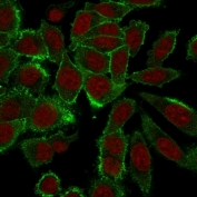 Immunofluorescent staining of PFA-fixed human HeLa cells with Moesin antibody (clone MSN/492).