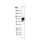 Western blot testing of human PC3 cell lysate with Moesin antibody. Predicted molecular weight ~68 kDa but routinely observed at 68-78 kDa.