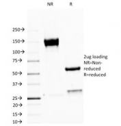 SDS-PAGE Analysis of Purified, BSA-Free MUC1 Antibody (clone MUC1/520). Confirmation of Integrity and Purity of the Antibody.
