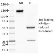 SDS-PAGE Analysis of Purified, BSA-Free MUC5AC Antibody (clone CLH2). Confirmation of Integrity and Purity of the Antibody.