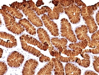 IHC: Formalin-fixed, paraffin-embedded human stomach stained with MUC5AC antibody (MUC5AC/917 + 45M1).~