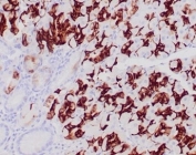 IHC staining of glandular cells of FFPE normal human stomach tissue with MUC6 antibody (clone CLH5). HIER: boil tissue sections in pH 9 10mM Tris with 1mM EDTA for 20 min and allow to cool before testing.