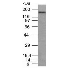 Western blot analysis of human HCT116 cell lysate using CD56 antibody. Predicted molecular weight: ~110 kDa (soluble fragment), ~120/125 kDa (GPI-anchored), 140/180 kDa (transmembrane isoforms).~