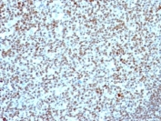 IHC: Formalin-fixed, paraffin-embedded human tonsil stained with Nucleolin antibody.