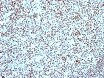 IHC: Formalin-fixed, paraffin-embedded human tonsil stained with Nucleolin antibody.