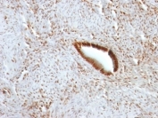 IHC: Formalin-fixed, paraffin-embedded human uterus stained with Nucleolin antibody.