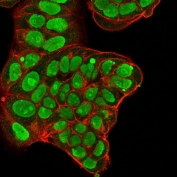 Immunofluorescent staining of PFA-fixed human MCF7 cells with Nucleolin antibody (green, clone NCL/902) and Phalloidin (red).