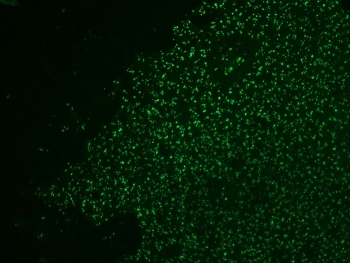 Immunofluorescent staining of human colon carcinoma with Nucleolin antibody (clone NCL/902, green