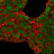 Immunofluorescent staining of PFA-fixed human MCF7 cells with anti-Nucleolin antibody (clone SPM614, green) and Phalloidin (red).