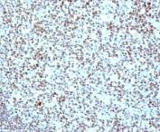IHC: Formalin-fixed, paraffin-embedded human tonsil stained with anti-Nucleolin antibody (clone SPM614).