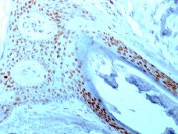 IHC: Formalin-fixed paraffin-embedded human skin stained with NCL antibody (364-5).~