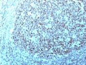 IHC: Formalin-fixed, paraffin-embedded human tonsil stained with Nucleolin antibody.