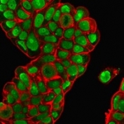 Immunofluorescent staining of PFA-fixed human MCF7 cells with Nucleolin antibody (green, clones 364-5 + NCL/902) and Phalloidin (red).