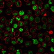 Immunofluorescent staining of PFA-fixed human K562 cells with Nucleolin antibody (green, clones 364-5 + NCL/902) and Phalloidin (red).