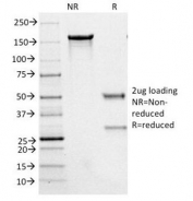 SDS-PAGE Analysis of Purified, BSA-Free NF-H Antibody (clone NE14). Confirmation of Integrity and Purity of the Antibody.