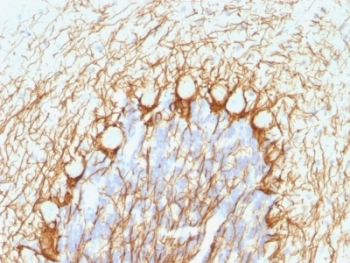 IHC: Formalin-fixed, paraffin-embedded human cerebellum stained with NF-H antibody (NE14).~